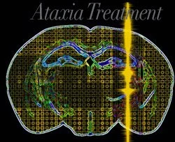 Ataxia-treatment-bangkok