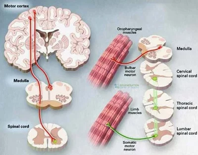 Stem-Cell-Treatment-ALS