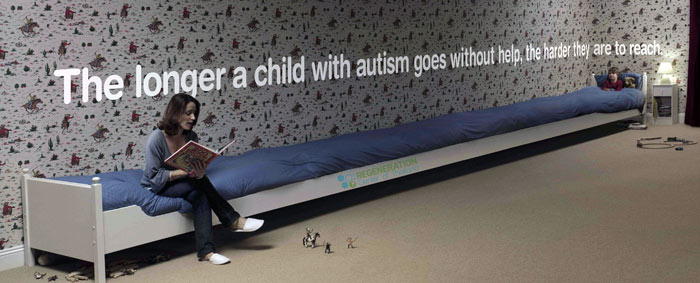 stem cell therapy autism