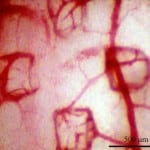 Stem-Cell-angiogenesis-Erectile-Dysfunction