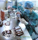 曼谷肾细胞移植
