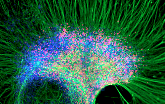 neural stemc cells