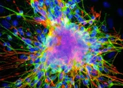 neural-stemcells