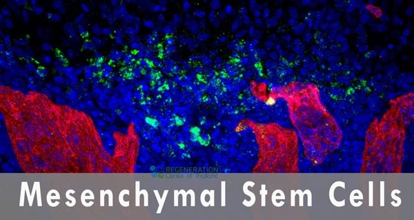 mesenchymal-stem-cells-therapy