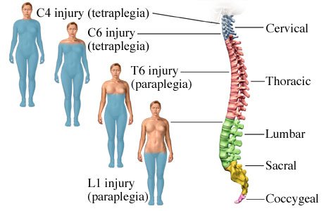 Stem-cell-treatment-of-Spinal-Cord-Injury
