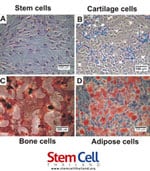 types-of-stem-cells-sports-injury-rehab