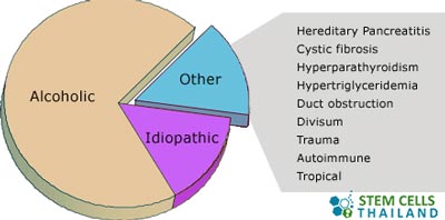 causes-of-Pancreatitis-and-pancreas-failure