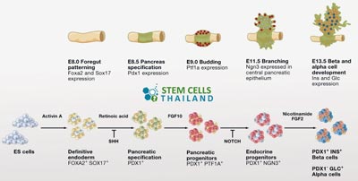 islet-cell-transplant-protocol-thailand