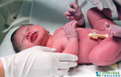 New Born Baby Feet And Umbilical Cord Stock Photo - Download Image Now -  Umbilical Cord, Blood, Stem Cell - iStock