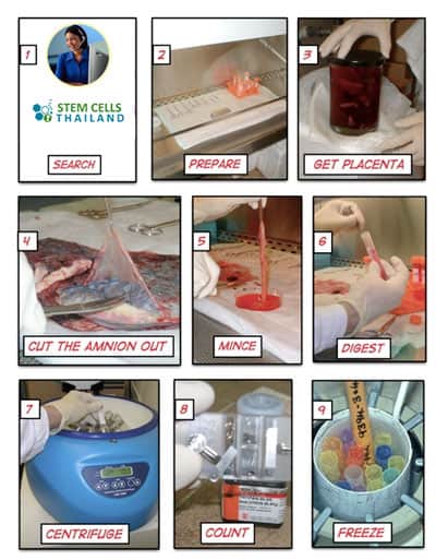 placental-stem-cell-banking-thailand-process-overview