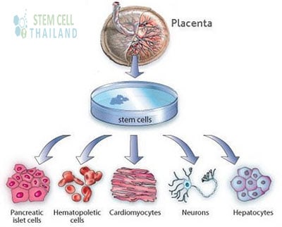 uses-for-placenta-derived-stem-cells