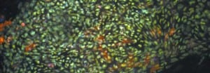 amniotic membrane cell