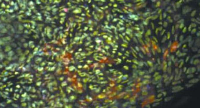 Amniotic Stem Cells & Amniotic fluid stem (hAFS)