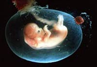 amniotic-stem-cells-placenta