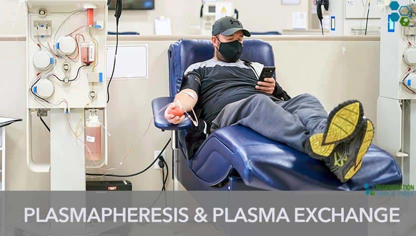 Apheresis-Plasmapheresis-Plasma-Exchange-stemcell-therapy