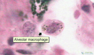 Human-Alveolar-Macrophage-cell