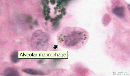 Human Alveolar Macrophage