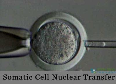 Somatic Cell Nuclear Transfer | SCNT nucleus of Somatic cells