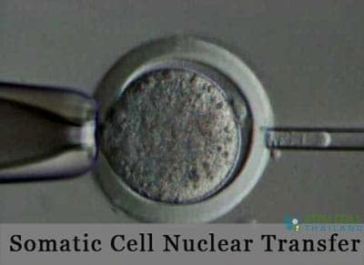 Somatic-Cell-Nuclear-Transfer-cloning
