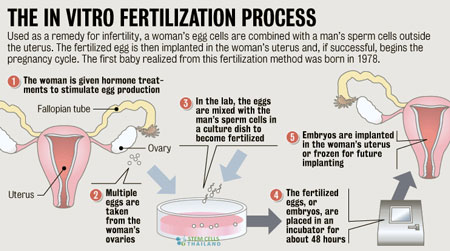 ivf-pgd-testing-bangkok-process-overview