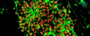 Induced Pluripotent Stem Cells