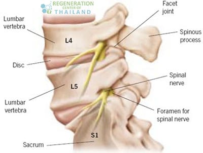 Sciatica - Regen Doctors