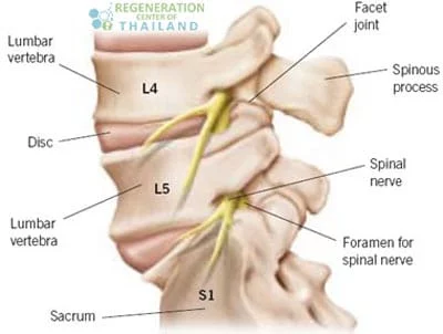 treat-sciatic-nerve-Injury-thailand