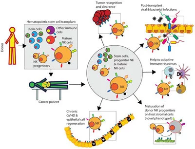 NK-cell-therapy