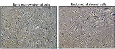 bone-marrow-stromal-cells-vs-endothelial-cells