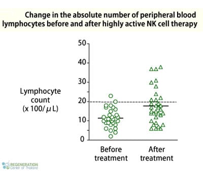 lymphocyte-nk-cell-treatment-before-and-after