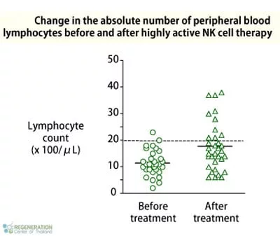 lymphocyte-nk-cell-treatment-before-and-after