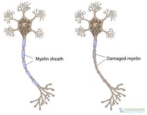 reparing-myelin-sheath-damage-thailand