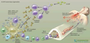 Granulocyte-Colony-Stimulating-Factor-G-CSF-Stimulation