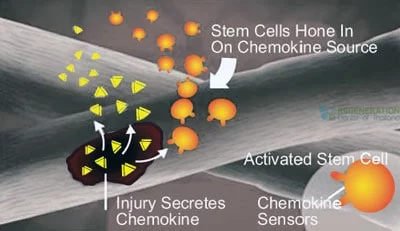 chemokines-stemcell-face-antiaging