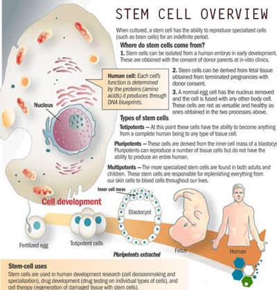 fibromyalgia-cell-therapy-prices-thailand-before-after