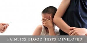 painless needlefree blood samples