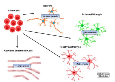 stem cell treatment for stroke results