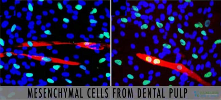 Mesenchymal cells from Dental
