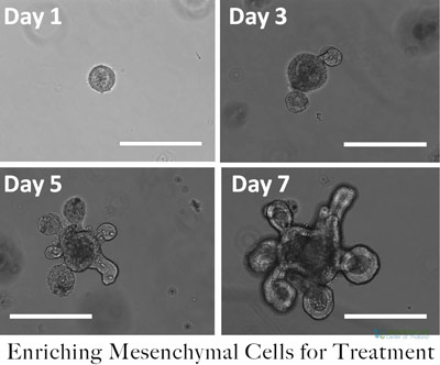 expanding-mesenchymal-stem-cell-transplants