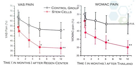 results-after-stem-cell-knee-repair