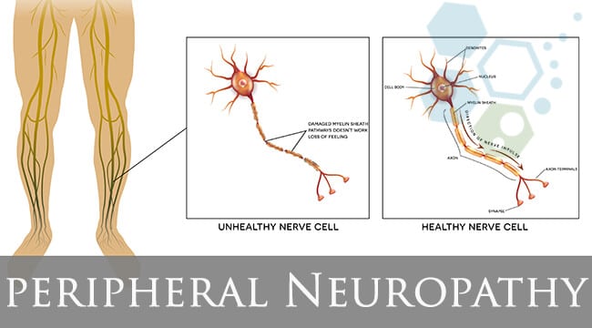 sensory nerve damage