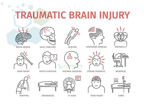 Neural Stem Cell Therapy for Brain Injuries CTE TBI