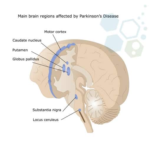 areas-affected-parkinsons
