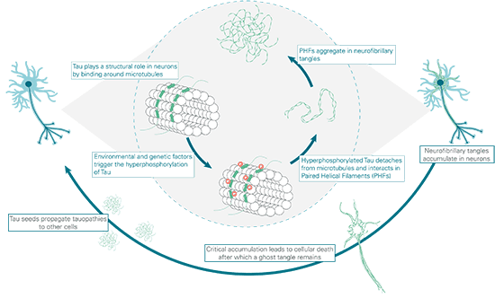 Double-prion-Disorders-alzheimers