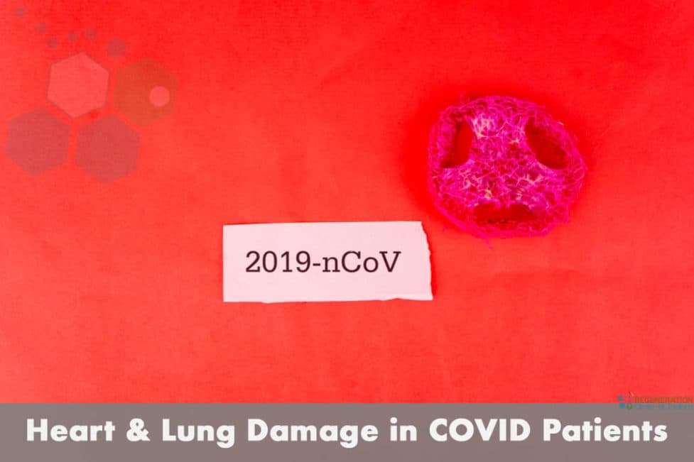 covid  heart damage lung