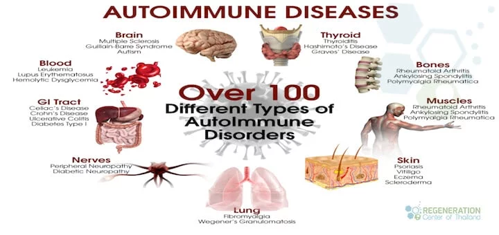 10-common-autoimmune-diseases