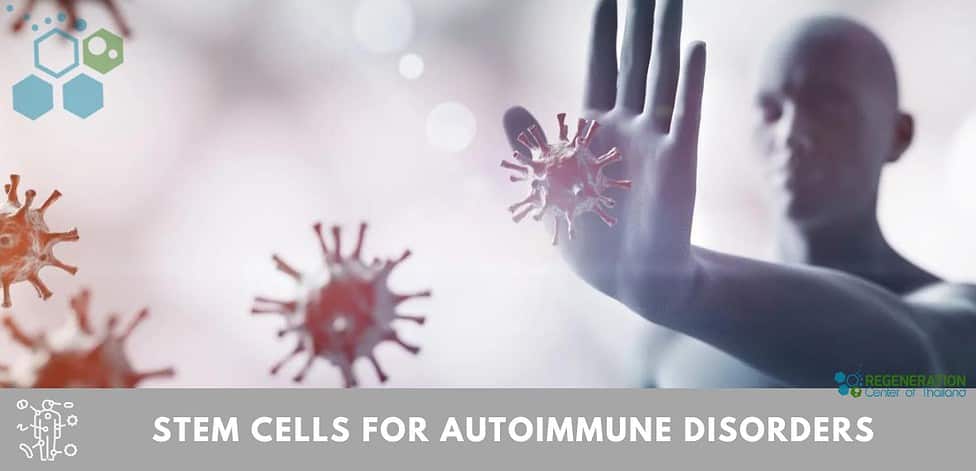 new Stem cell therapy for Autoimmune Disease