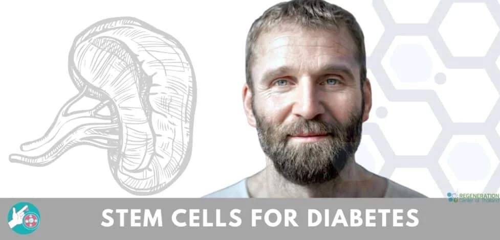stem cell treatment diabetes