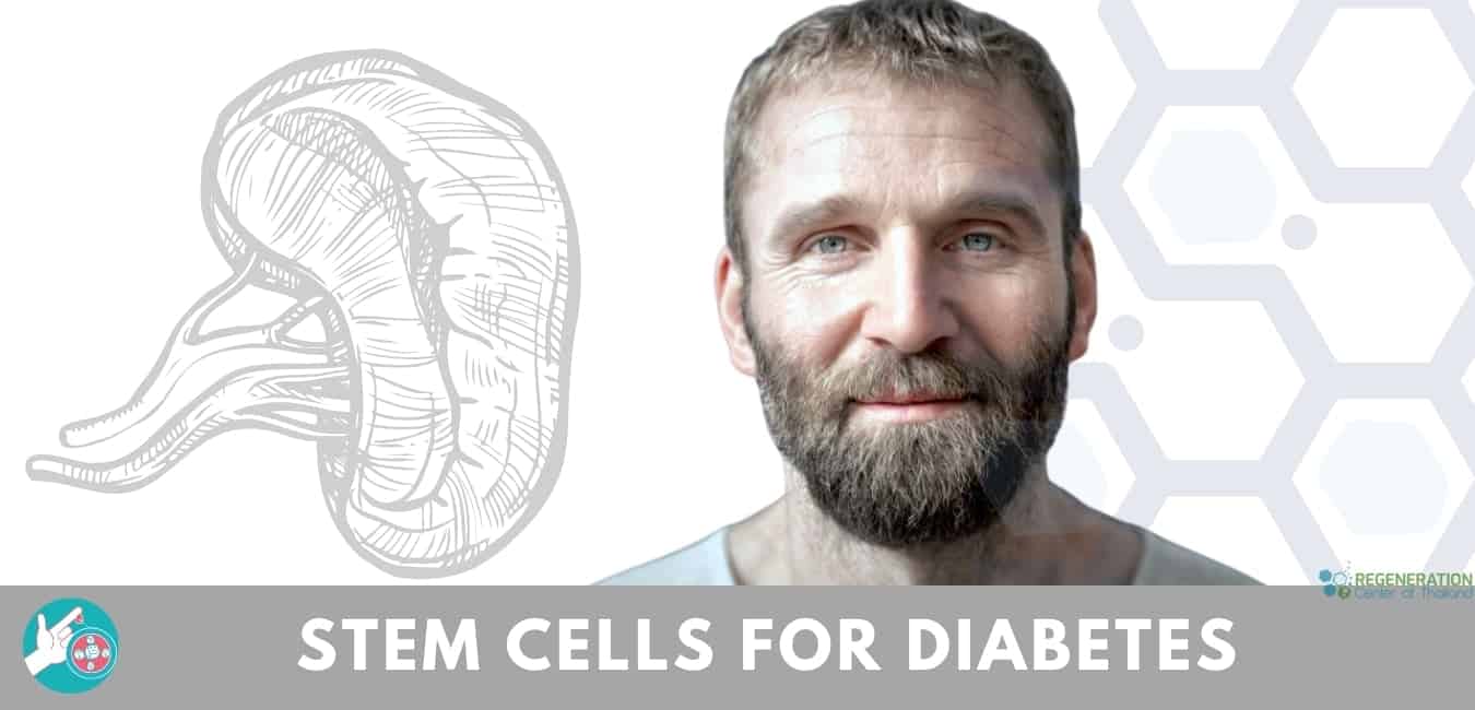 a cukorbetegség kezelése stem cells