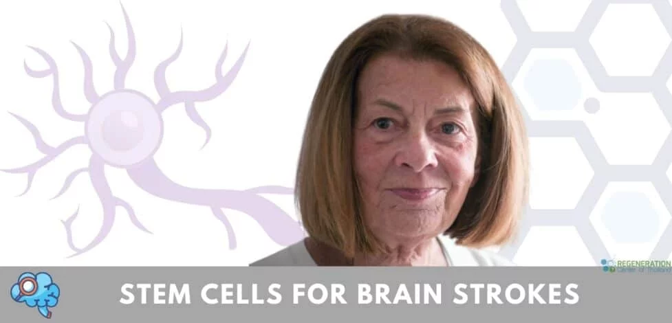stem cells for treatment of strokes